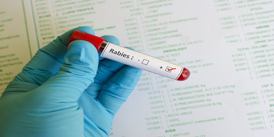 DPH Cautions Public To Watch For Rabid Animals During Active Season
